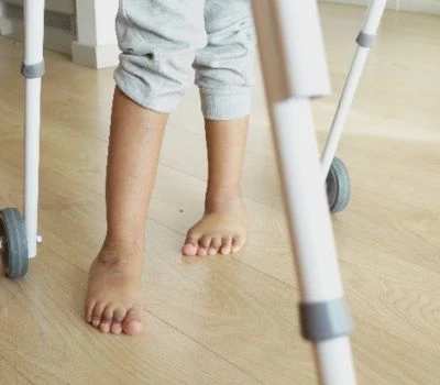אי התאמה באורך הרגל: הבנת חוסר איזון, זיהוי נזקים ומציאת בהירות עם סריקת גוף תלת מימדית